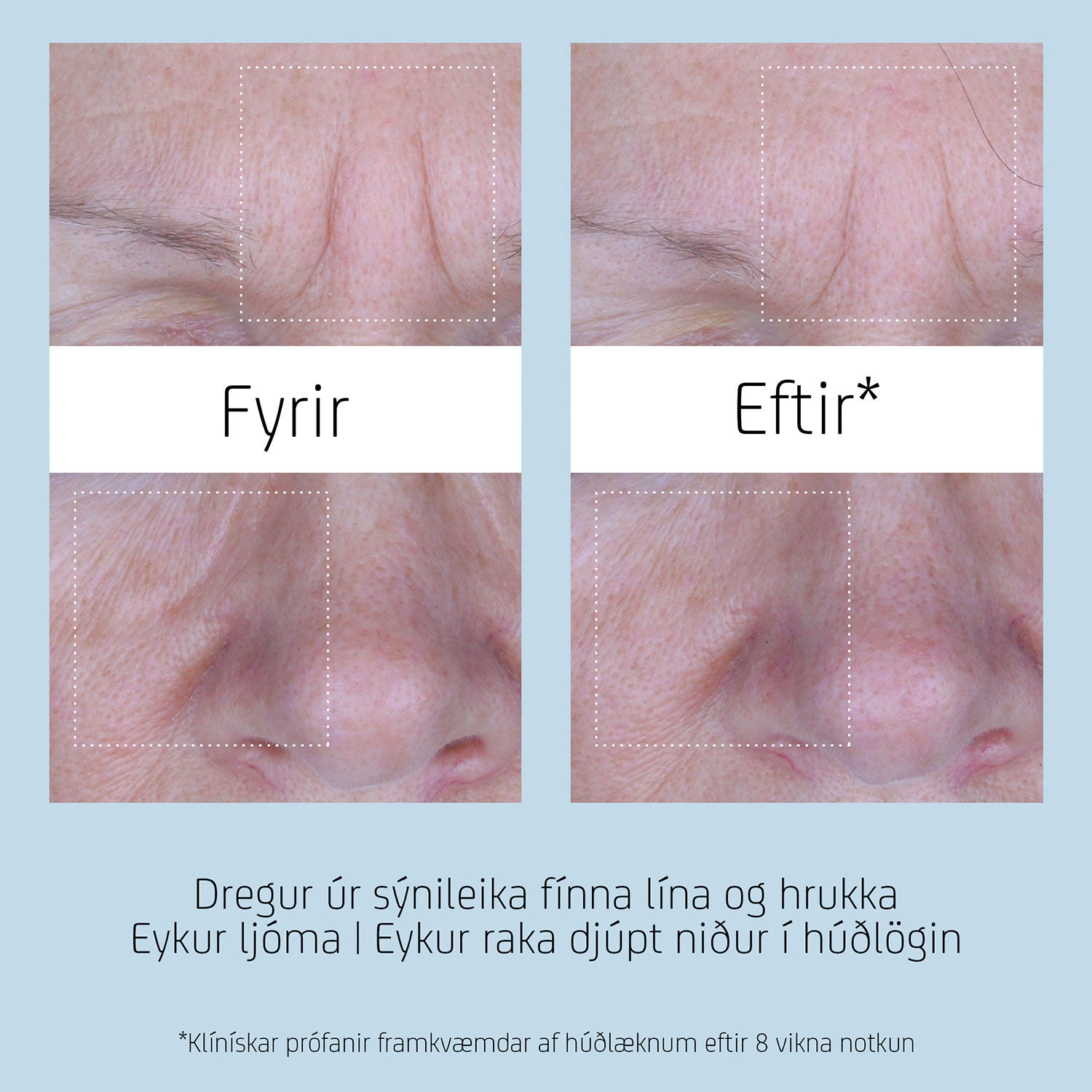 Fyrir og eftir mynd sem sýnir útlit húðar eftir notkun á BL+ The Serum